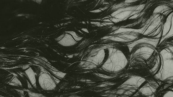 Über starken Haarausfall