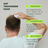 Scalp Massager