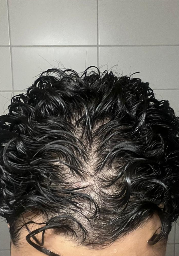 Before - Fayadh